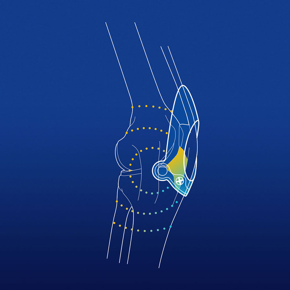 Illustration: First massaging hoffa spot on GenuTrain 8