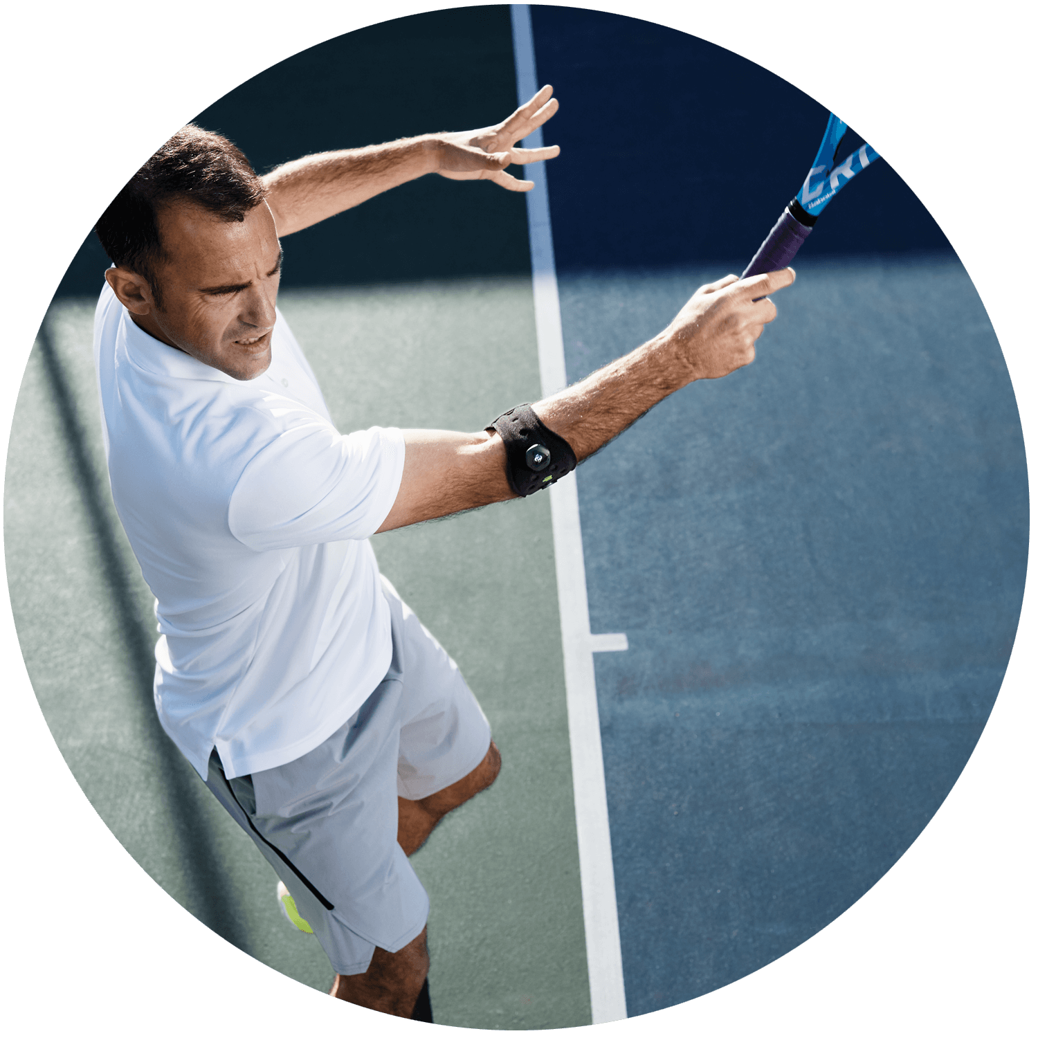 Tennis Elbow Tennis Elbow