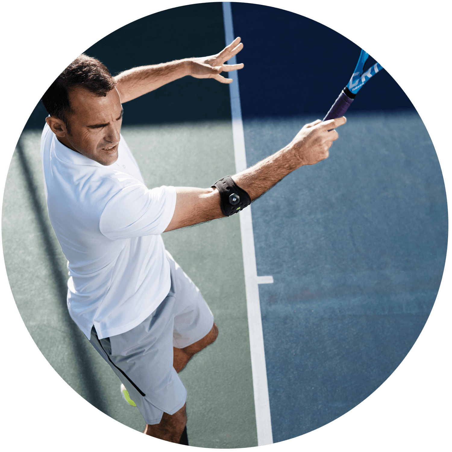 Tennis Elbow