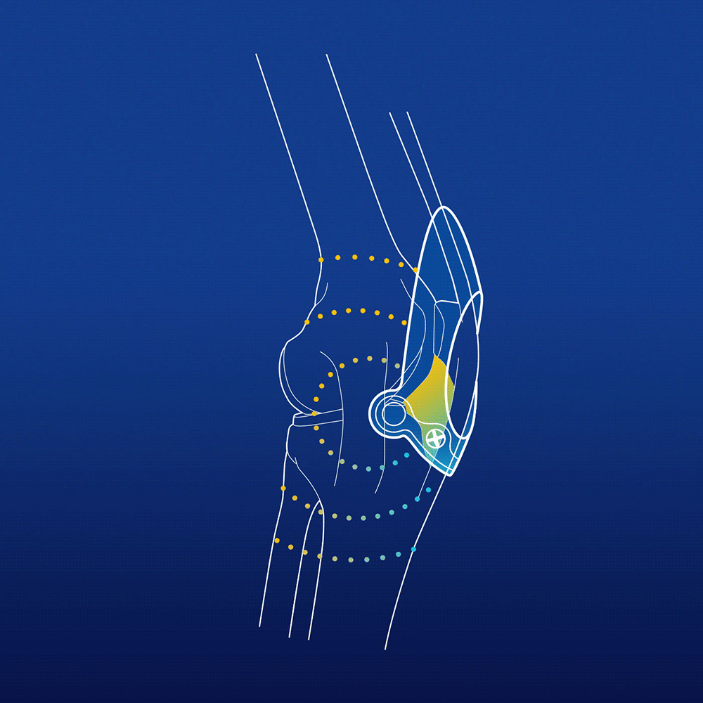 Illustration: Knee pain Illustration: Knee pain