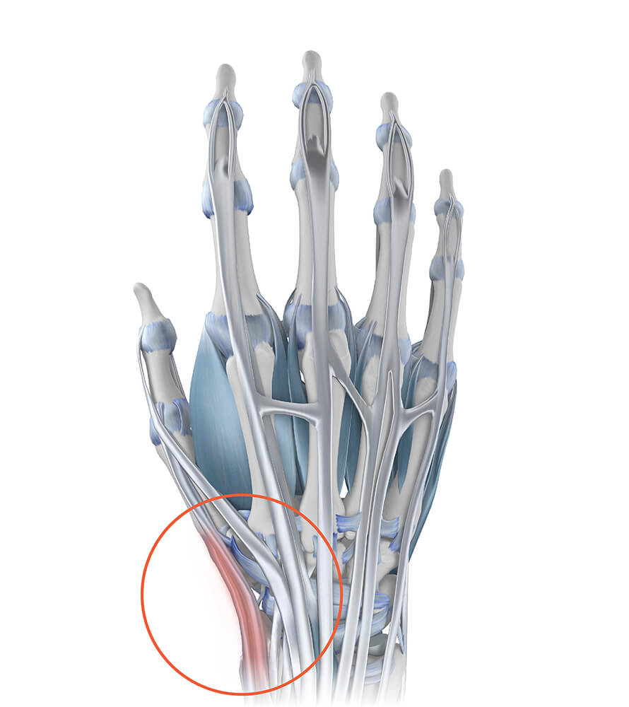 Wrist pain has various causes Wrist pain has various causes