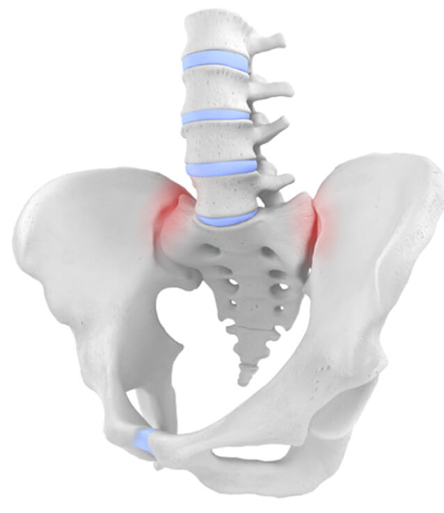 Hip Anatomy Image Hip Anatomy Image