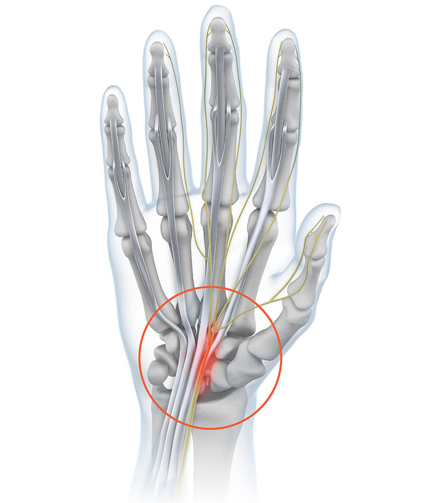 Wrist pain has various causes