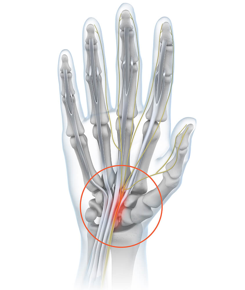 Wrist pain has various causes Wrist pain has various causes