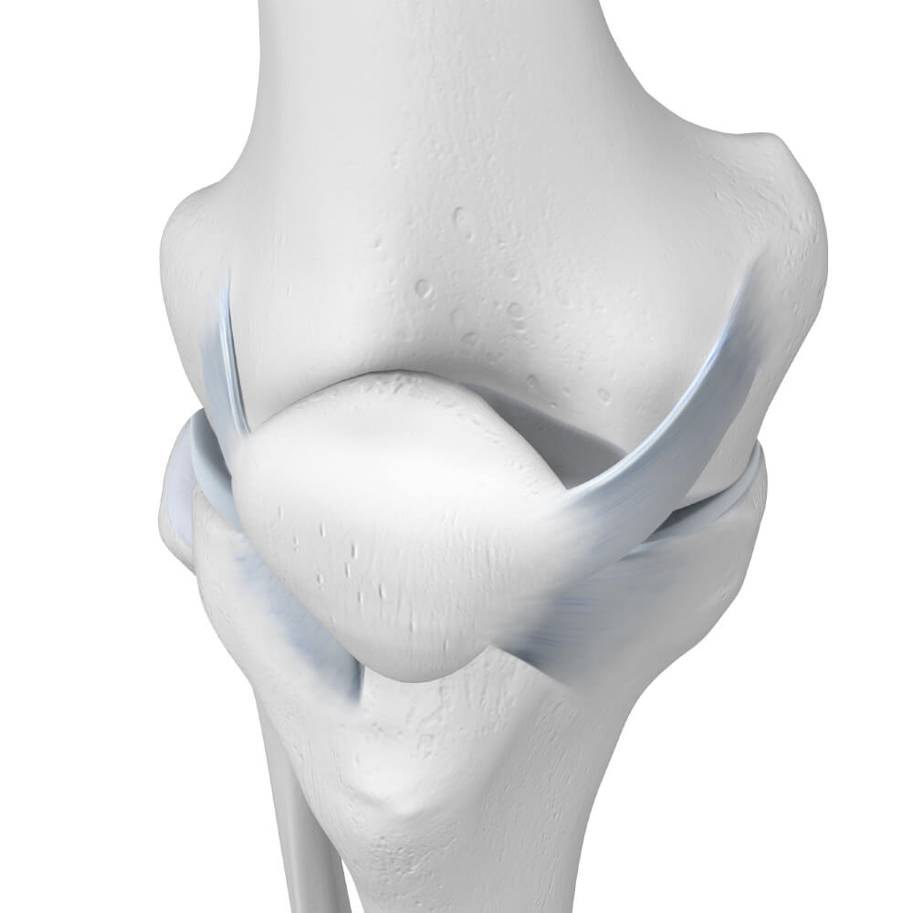 Patella Tracking Illustration