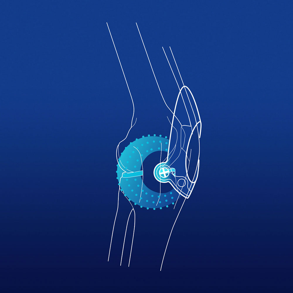 Illustration: Second Massaging hoffa spot on GenuTrain 8