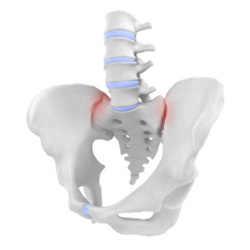 Back pain has various causes Back pain has various causes