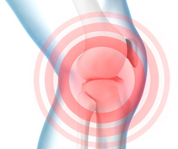 Swollen Knee Illustration