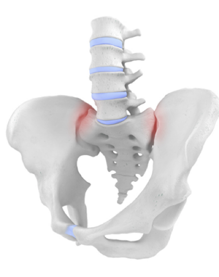 SI Joint Image