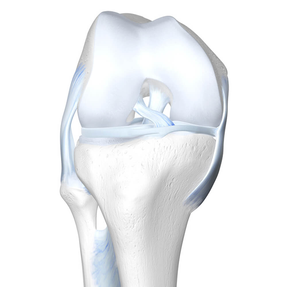 Sprained Knee Illustration Sprained Knee Illustration