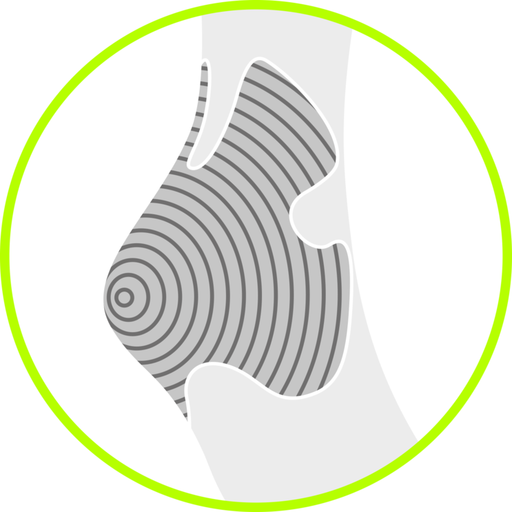 Heel Protection Image